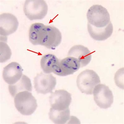  Babesia! Ein Parasit mit versteckten Talenten und einer Vorliebe für Blut