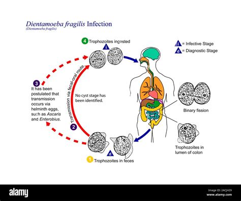  Dientamoeba Fragilis: Ein Parasit mit unscheinbarer Erscheinung, der das Verdauungssystem auf den Kopf stellen kann!